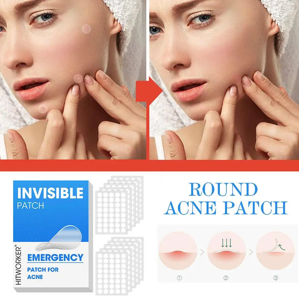 Averon™ Invisible Hydrocolloid Pimple Acne