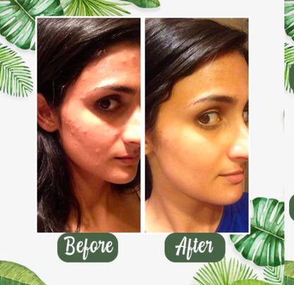 Daystar™ (Buy 1, Get 2)